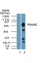 PRAME Antibody