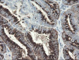 SLA2 / SLAP2 Antibody (clone OTI3E3)