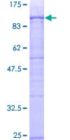 Human XRCC6 / Ku70 Protein (Recombinant GST)