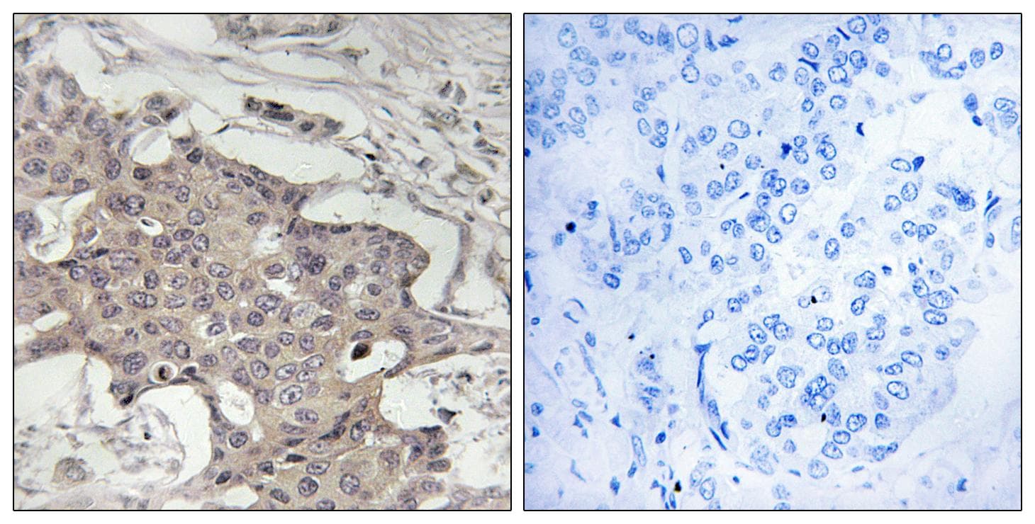 Polyclonal Rabbit anti-Human HIBADH Antibody (IHC)