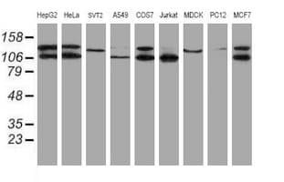 Monoclonal Mouse anti-Human SENP2 Antibody (clone OTI6F1, IHC, IF, WB)