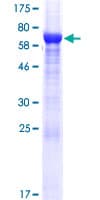 Human VAT1L Protein (Recombinant GST)
