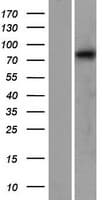 CAPN12 / Calpain 12 Protein (Over-Expression Lysate Myc-DDK (Flag))