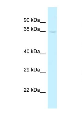 TRMT5 Antibody (aa256-305)