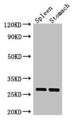 Polyclonal Rabbit anti-Human CTRB1 / Chymotrypsinogen B1 Antibody