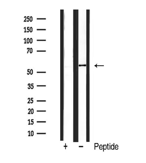BMP6 Antibody