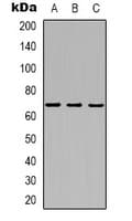 Polyclonal Rabbit anti-Human MT-ND5 Antibody (Internal, WB)