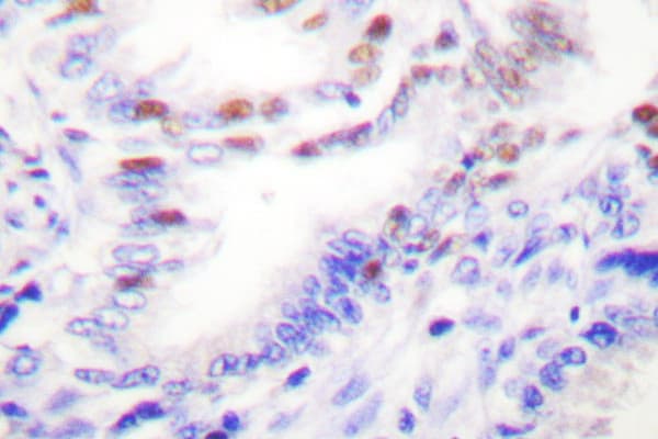 PRKCZ / PKC-Zeta Antibody (phospho-Thr410)