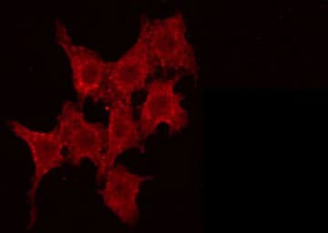 Polyclonal Rabbit anti-Human AKAP14 Antibody (IF, WB)