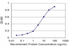 MPHOSPH10 / MPP10 Antibody (clone 1E12)