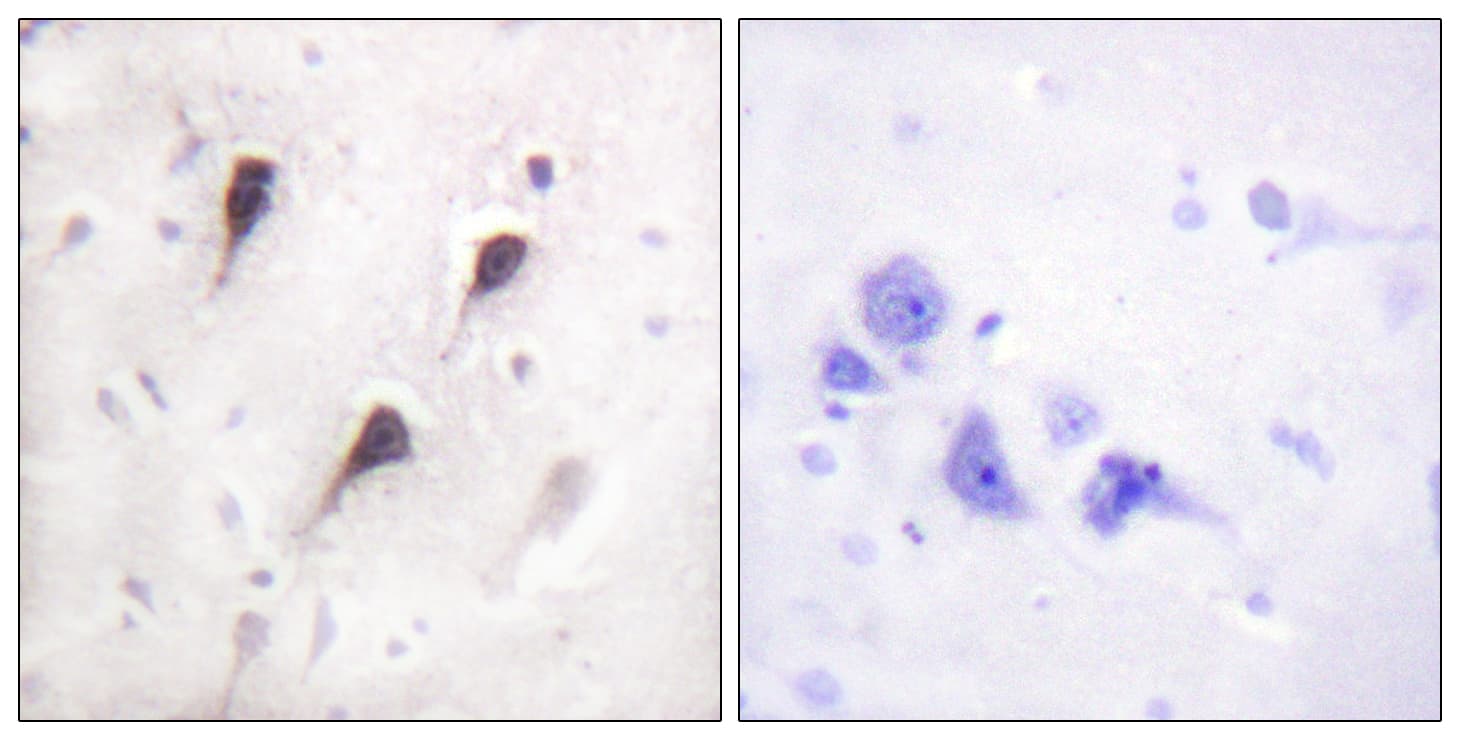WASF1 / WAVE Antibody (aa91-140)