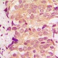 MAPK14 / p38 Antibody (C-Terminus)