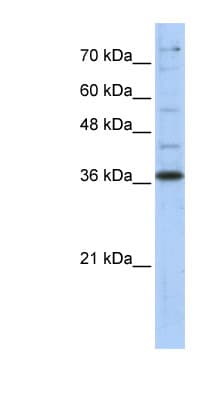 GAPDH Antibody (aa107-156)