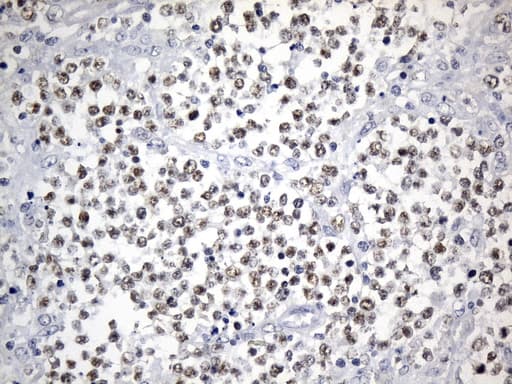 FOXP1 Antibody (clone UMAB242, Carrier-free)