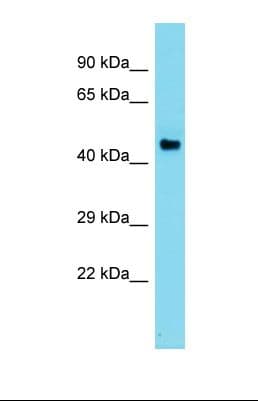 AZIN2 / Antizyme Inhibitor 2 Antibody (aa274-323)