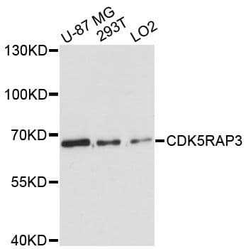 Polyclonal Rabbit anti-Human CDK5RAP3 Antibody (WB)