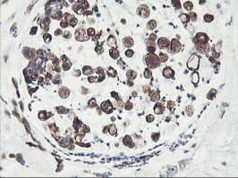 PFKP Antibody (clone OTI1D6)