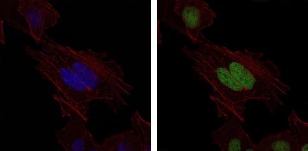 MSH6 Antibody (clone 30)