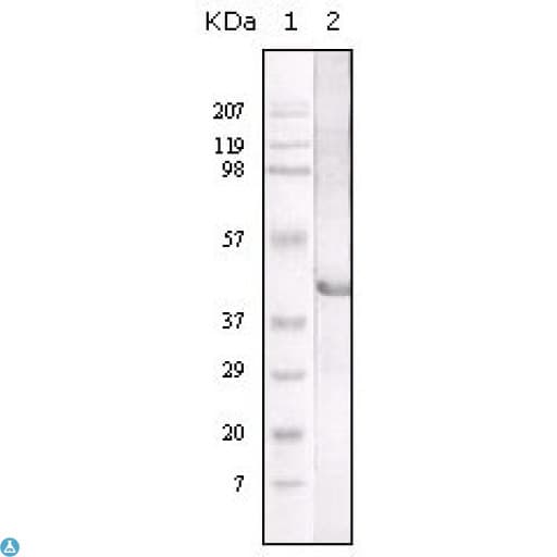 LIPA / Lysosomal Acid Lipase Antibody