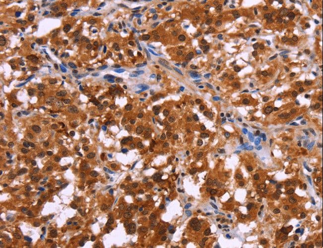 USP2 Antibody