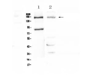 NPC / NPC1 Antibody