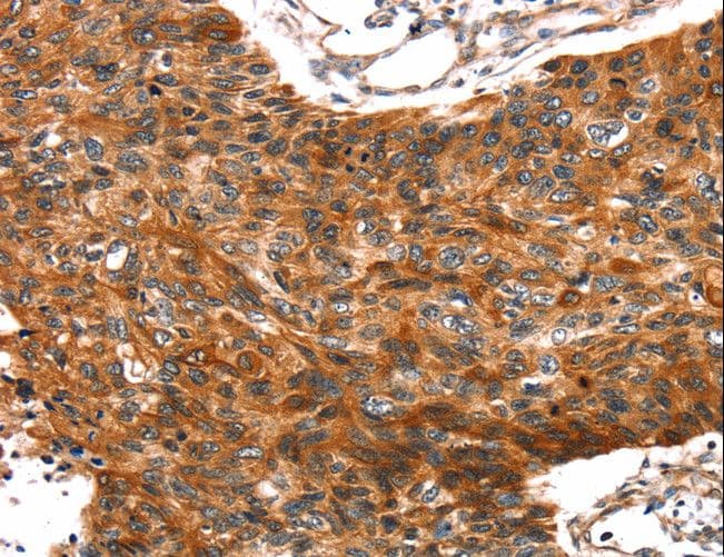 Polyclonal Rabbit anti-Human TRIM69 / Trif Antibody (IHC)