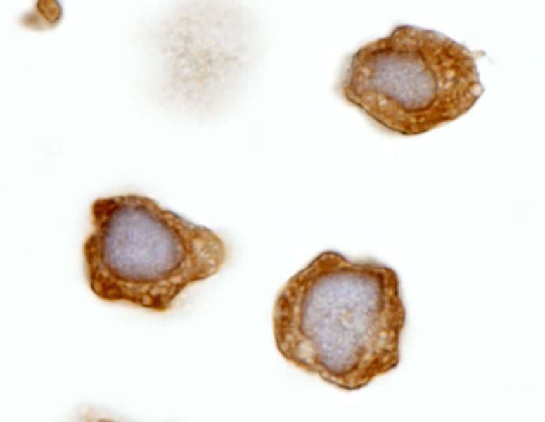 IHC-plus™ Polyclonal Rabbit anti-Human ABL1 / c-ABL Antibody (aa850-900, IHC, IF)