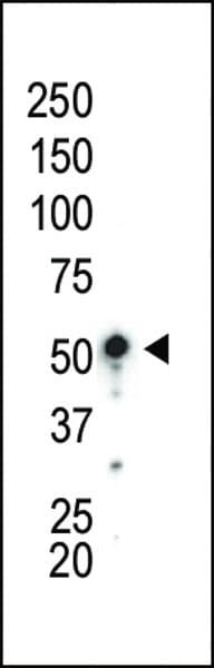 Polyclonal Rabbit anti-Human PRKAA1 / AMPK Alpha 1 Antibody (aa479-510, WB)