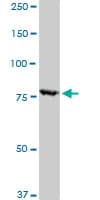 RPS6KA1 / RSK1 Antibody (clone 4E11)