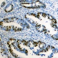 ZEB2 / SIP-1 Antibody (N-Terminus)