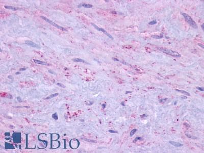 PathPlus™ Polyclonal Rabbit anti-Human DRD1 / Dopamine Receptor D1 Antibody (Cytoplasmic Domain, IHC)