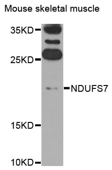 Polyclonal Rabbit anti-Human NDUFS7 Antibody (IHC, WB)