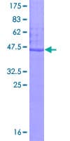 Human ESM1 / Endocan Protein (Recombinant GST)