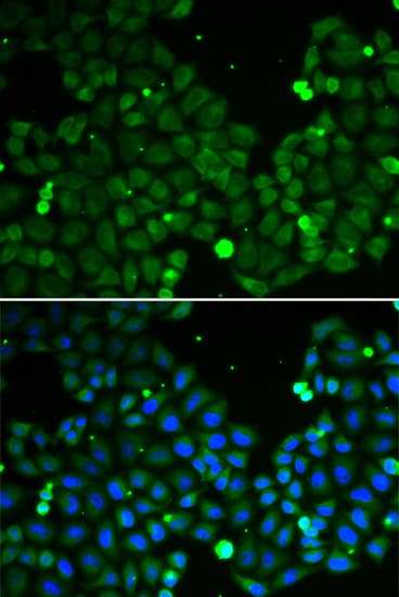 Polyclonal Rabbit anti-Human HIF1AN Antibody (IHC, IF, WB)