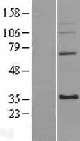 MRPL4 / MRP-L4 Protein (Over-Expression Lysate Myc-DDK (Flag))