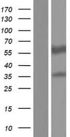 RALDH2 / ALDH1A2 Protein (Over-Expression Lysate Myc-DDK (Flag))