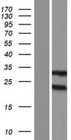 GSTM2 Protein (Over-Expression Lysate Myc-DDK (Flag))