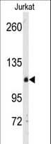 DGKD Antibody (aa1061-1091)