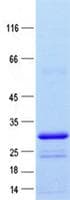 Human ACVRL1 Protein (Recombinant ABP-His, N-terminus)