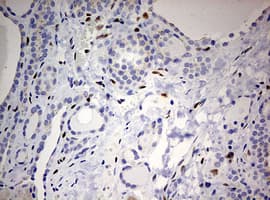 ZEB1 / AREB6 Antibody (aa1-350, clone OTI7E12)
