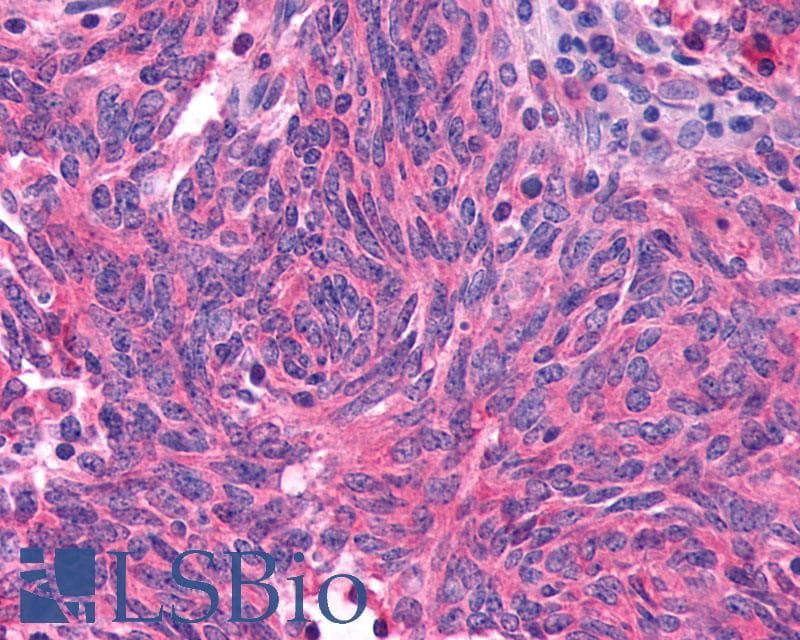 PathPlus™ Polyclonal Rabbit anti-Human GLP1R / GLP-1 Receptor Antibody (N-Terminus, IHC)