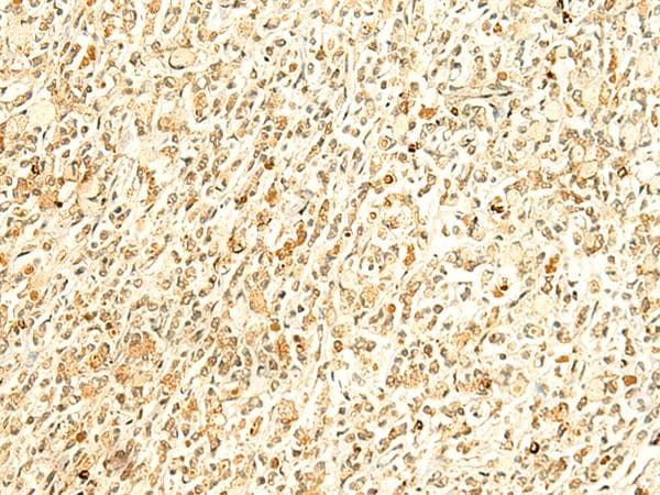 HMBOX1 Antibody