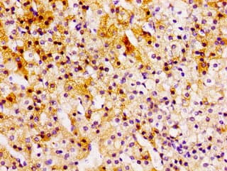 Polyclonal Rabbit anti-Human CCL15 / MIP5 Antibody (IHC)