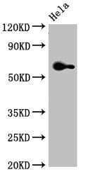 FZD4 / Frizzled 4 Antibody