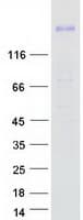 Human ROBO1 Protein (Recombinant Myc-DDK (Flag))