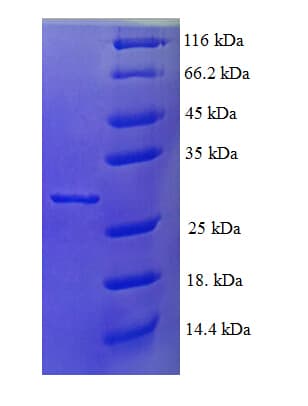 Human L35A / RPL35A Protein (Recombinant His-SUMO)