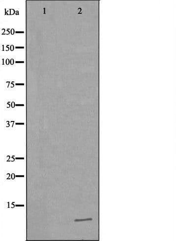 Polyclonal Rabbit anti-Human TFF1 / pS2 Antibody (IHC, WB)