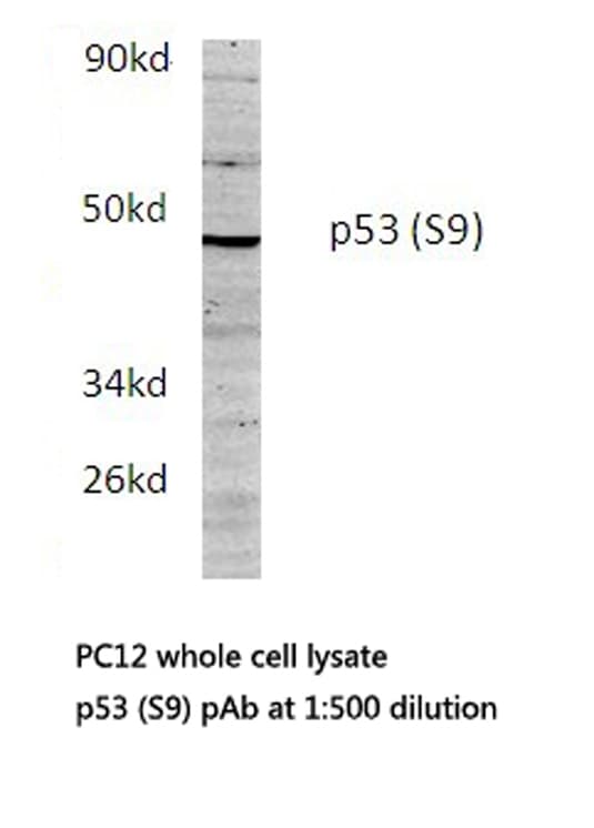 TP53 / p53 Antibody (Ser9)