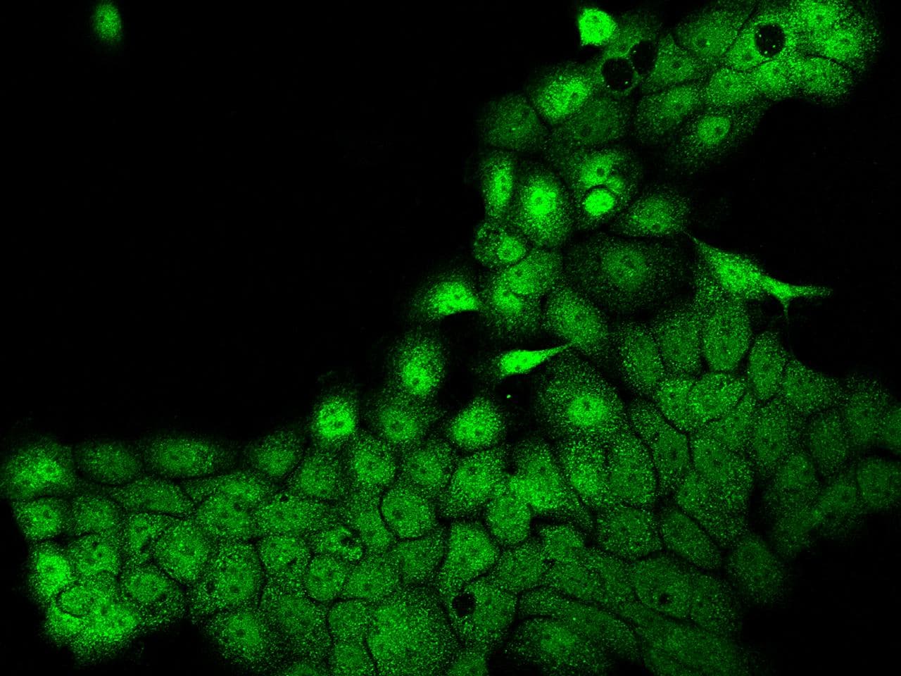 POLR3H Antibody