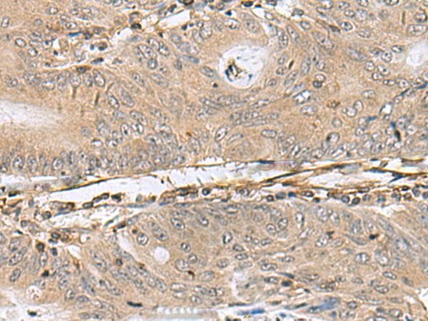 PTPRS Antibody
